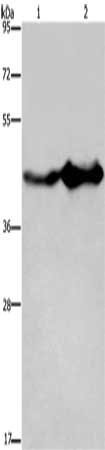Gel: 8%SDS-PAGE, Lysate: 40 μg, Lane 1-2: Mouse liver tissue, Mouse brain tissue, Primary antibody: GLUL Antibody(GLUL Antibody) at dilution 1/600, Secondary antibody: Goat anti rabbit IgG at 1/8000 dilution, Exposure time: 10 secondsRabbit anti-Human GLUL Polyclonal Antibody