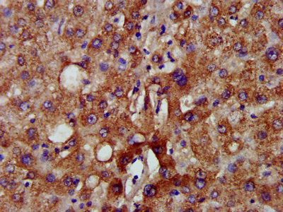 IHC image of NADK2 Antibody diluted at 1:500 and staining in paraffin-embedded human liver tissue performed on a Leica BondTM system. After dewaxing and hydration, antigen retrieval was mediated by high pressure in a citrate buffer (pH 6.0). Section was blocked with 10% normal goat serum 30min at RT. Then primary antibody (1% BSA) was incubated at 4°C overnight. The primary is detected by a biotinylated secondary antibody and visualized using an HRP conjugated SP system.Rabbit anti-Human NADK2 Polyclonal Antibody