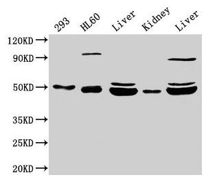 Western Blot  | Positive WB detected in: 293 whole cell lysate, HL60 whole cell lysate, Rat liver tissue, Mouse kidney tissue, Mouse liver tissue  | All lanes: NADK2 antibody at 4µg/ml  | Secondary  | Goat polyclonal to rabbit IgG at 1/50000 dilution  | Predicted band size: 50, 46, 32 kDa  | Observed band size: 50, 46 kDaRabbit anti-Human NADK2 Polyclonal Antibody