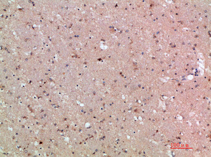 Immunohistochemical analysis of paraffin-embedded human-brain, antibody was diluted at 1:200Rabbit anti-Human ASCL1 Polyclonal Antibody