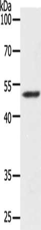 Gel: 8+10+12%SDS-PAGE, Lysate: 50 μg, Lane: Human lymphoma tissue, Primary antibody: Map2 Antibody(Map2 Antibody) at dilution 1/400, Secondary antibody: Goat anti rabbit IgG at 1/8000 dilution, Exposure time: 90 secondsRabbit Map2 Polyclonal Antibody
