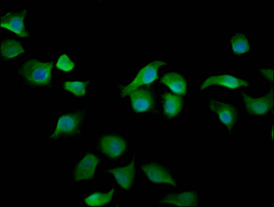 Immunofluorescence staining of A549 cells with ARHGAP15 Antibody at 1:200, counter-stained with DAPI. The cells were fixed in 4% formaldehyde, permeabilized using 0.2% Triton X-100 and blocked in 10% normal Goat Serum. The cells were then incubated with the antibody overnight at 4°C. The secondary antibody was Alexa Fluor 488-congugated AffiniPure Goat Anti-Rabbit IgG(H+L).Rabbit anti-Human ARHGAP15 Polyclonal Antibody