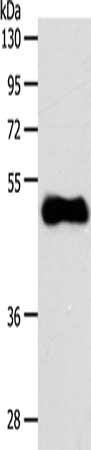 Gel: 10%SDS-PAGE, Lysate: 40 μg, Lane: Human fetal brain tissue, Primary antibody: S1PR3 Antibody(S1PR3 Antibody) at dilution 1/700, Secondary antibody: Goat anti rabbit IgG at 1/8000 dilution, Exposure time: 20 secondsRabbit anti-Human S1PR3 Polyclonal Antibody