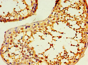 Immunohistochemistry of paraffin-embedded human testis tissue using DNAL1 Antibody at dilution of 1:100Rabbit anti-Human DNAL1 Polyclonal Antibody