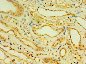 Immunohistochemistry of paraffin-embedded human kidney tissue using DNAL1 Antibody at dilution of 1:100Rabbit anti-Human DNAL1 Polyclonal Antibody
