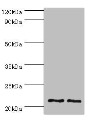 Western blot | All lanes: DNAL1 antibody at 4μg/ml | Lane 1: Hela whole cell lysate | Lane 2: HepG2 whole cell lysate | Secondary | Goat polyclonal to rabbit IgG at 1/10000 dilution | Predicted band size: 22, 9, 18 kDa | Observed band size: 22 kDaRabbit anti-Human DNAL1 Polyclonal Antibody