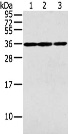 Gel: 12%SDS-PAGE, Lysate: 40 μg, Lane 1-3: 231 cell, mouse brain tissue and A549 cell, Primary antibody: PITX3 Antibody(PITX3 Antibody) at dilution 1/200 dilution, Secondary antibody: Goat anti rabbit IgG at 1/8000 dilution, Exposure time: 40 secondsRabbit anti-Human PITX3 Polyclonal Antibody
