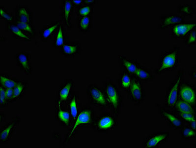 Immunofluorescent analysis of Hela cells using PCOTH Antibody at dilution of 1:100 and Alexa Fluor 488-congugated AffiniPure Goat Anti-Rabbit IgG(H+L)Rabbit anti-Human PCOTH Polyclonal Antibody