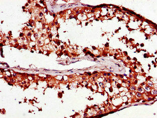 Immunohistochemistry of paraffin-embedded human testis tissue using PCOTH Antibody at dilution of 1:100Rabbit anti-Human PCOTH Polyclonal Antibody