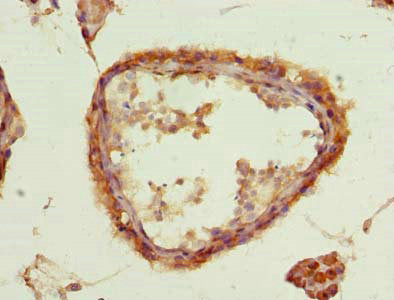 Immunohistochemistry of paraffin-embedded human testis tissue using ACSBG2 Antibody at dilution of 1:100