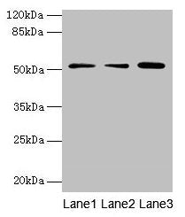 Western blot  | All lanes: ACSBG2 antibody at 4µg/ml  | Lane 1: A431 whole cell lysate  | Lane 2: K562 whole cell lysate  | Lane 3: A549 whole cell lysate  | Secondary  | Goat polyclonal to rabbit IgG at 1/10000 dilution  | Predicted band size: 75, 69, 54, 52 kDa  | Observed band size: 52 kDa