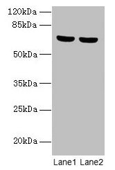 Western blot  | All lanes: SYTL3 antibody at 5µg/ml  | Lane 1: A549 whole cell lysate  | Lane 2: THP-1 whole cell lysate  | Secondary  | Goat polyclonal to rabbit IgG at 1/10000 dilution  | Predicted band size: 69, 61 kDa  | Observed band size: 69 kDaRabbit anti-Human SYTL3 Polyclonal Antibody
