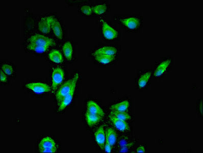 Immunofluorescent analysis of HepG2 cells using RFTN2 Antibody at dilution of 1:100 and Alexa Fluor 488-congugated AffiniPure Goat Anti-Rabbit IgG(H+L)