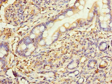 Immunohistochemistry of paraffin-embedded human small intestine tissue using HSD17B12 Antibody at dilution of 1:100Rabbit anti-Human HSD17B12 Polyclonal Antibody