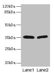 Western blot  | All lanes: HSD17B12 antibody at 1.2µg/ml  | Lane 1: U251 whole cell lysate  | Lane 2: A431 whole cell lysate  | Secondary  | Goat polyclonal to rabbit IgG at 1/10000 dilution  | Predicted band size: 35, 11 kDa  | Observed band size: 35 kDaRabbit anti-Human HSD17B12 Polyclonal Antibody