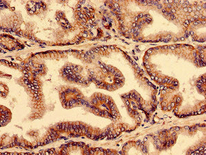 Immunohistochemistry analysis of human prostate tissue using the antibody at dilution of 1:100Rabbit anti-Human YIF1B Polyclonal Antibody