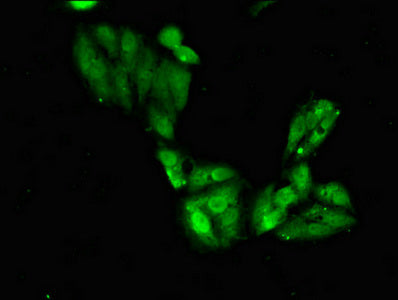 Immunofluorescent analysis of Hela cells using SGO1 Antibody at dilution of 1:100 and Alexa Fluor 488-congugated AffiniPure Goat Anti-Rabbit IgG(H+L)Rabbit anti-Human SGO1 Polyclonal Antibody