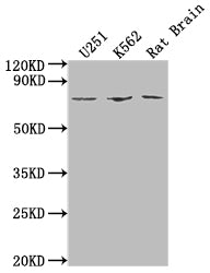 Western Blot | Positive WB detected in: U251 whole cell lysate, K562 whole cell lysate, Rat Brain tissue | All lanes: SGO1 antibody at 1:2000 | Secondary | Goat polyclonal to rabbit IgG at 1/50000 dilution | Predicted band size: 65, 36, 34, 32, 30, 61, 25 kDa | Observed band size: 65 kDaRabbit anti-Human SGO1 Polyclonal Antibody