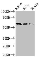 Western Blot | Positive WB detected in: MCF-7 whole cell lysate, Hela whole cell lysate, Mouse brain tissue | All lanes: SGO1 antibody at 3μg/ml | Secondary | Goat polyclonal to rabbit IgG at 1/50000 dilution | Predicted band size: 65, 36, 34, 32, 30, 61, 25 kDa | Observed band size: 65 kDaRabbit anti-Human SGO1 Polyclonal Antibody