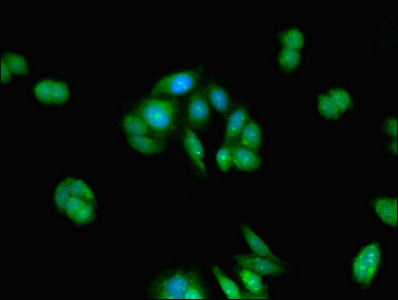 Immunofluorescent analysis of HepG2 cells using TMEM67 Antibody at dilution of 1:100 and Alexa Fluor 488-congugated AffiniPure Goat Anti-Rabbit IgG(H+L)Rabbit anti-Human TMEM67 Polyclonal Antibody