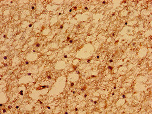 Immunohistochemistry of paraffin-embedded human brain tissue using the antibody at dilution of 1:100Rabbit anti-Human TMEM67 Polyclonal Antibody