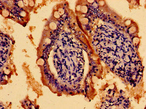 Immunohistochemistry of paraffin-embedded human small intestine tissue using TMEM67 Antibody at dilution of 1:100Rabbit anti-Human TMEM67 Polyclonal Antibody