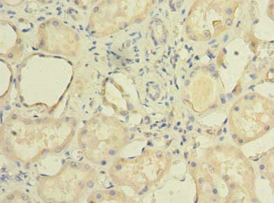 Immunohistochemistry of paraffin-embedded human kidney tissue using TCTE1 Antibody at dilution of 1:100Rabbit anti-Human TCTE1 Polyclonal Antibody