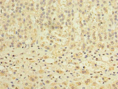 Immunohistochemistry of paraffin-embedded human adrenal gland tissue using TCTE1 Antibody at dilution of 1:100Rabbit anti-Human TCTE1 Polyclonal Antibody