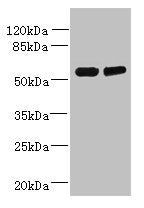 Western blot  | All lanes: TCTE1 antibody at 3µg/ml  | Lane 1: U251 whole cell lysate  | Lane 2: Mouse brain tissue  | Secondary  | Goat polyclonal to rabbit IgG at 1/10000 dilution  | Predicted band size: 56 kDa  | Observed band size: 56 kDaRabbit anti-Human TCTE1 Polyclonal Antibody