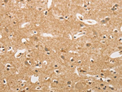 The image on the left is immunohistochemistry of paraffin-embedded Human brain  tissue using NFE2L1 Antibody(NFE2L1 Antibody) at dilution 1/20, on the right is treated with fusion protein. (Original magnification: ×200)Rabbit anti-Human NFE2L1 Polyclonal Antibody