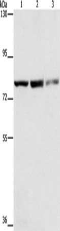 Gel: 6%SDS-PAGE, Lysate: 40 μg, Lane 1-3: Raji cells, hepG2 cells, hela cells, Primary antibody: NFE2L1 Antibody(NFE2L1 Antibody) at dilution 1/250, Secondary antibody: Goat anti rabbit IgG at 1/8000 dilution, Exposure time: 20 secondsRabbit anti-Human NFE2L1 Polyclonal Antibody