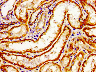 Immunohistochemistry of paraffin-embedded human kidney tissue using ARHGAP1 Antibody at dilution of 1:100Rabbit anti-Human ARHGAP1 Polyclonal Antibody