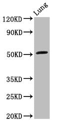 Western Blot | Positive WB detected in: Rat lung tissue | All lanes: ARHGAP1 antibody at 3.2μg/ml | Secondary | Goat polyclonal to rabbit IgG at 1/50000 dilution | Predicted band size: 51 kDa | Observed band size: 51 kDaRabbit anti-Human ARHGAP1 Polyclonal Antibody