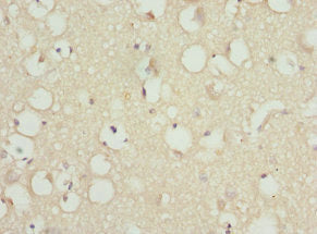 Immunohistochemistry of paraffin-embedded human brain tissue using PITRM1 Antibody at dilution of 1:100Rabbit anti-Human PITRM1 Polyclonal Antibody