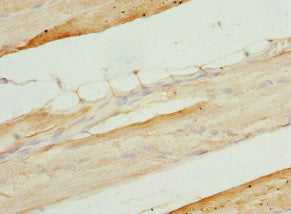Immunohistochemistry of paraffin-embedded human skeletal muscle tissue using PITRM1 Antibody at dilution of 1:100Rabbit anti-Human PITRM1 Polyclonal Antibody