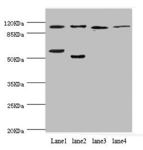 Western blot | All lanes: PITRM1 antibody at 2.42μg/ml | Lane 1: Mouse placenta tissue | Lane 2: A549 whole cell lysate | Lane 3: Rat gonad tissue | Lane 4: Mouse kidney tissue | Secondary | Goat polyclonal to rabbit IgG at 1/10000 dilution | Predicted band size: 118, 107 kDa | Observed band size: 118, 50 kDaRabbit anti-Human PITRM1 Polyclonal Antibody