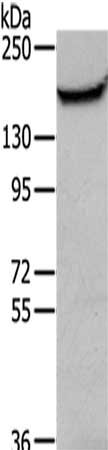 Gel: 6%SDS-PAGE,Lysate: 40 μg,,Primary antibody: MUC1 Antibody(MUC1 Antibody) at dilution 1/200 dilution,Secondary antibody: Goat anti rabbit IgG at 1/8000 dilution,Exposure time: 5 minutesRabbit anti-Human MUC1 Polyclonal Antibody