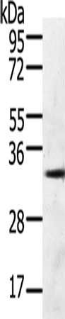 Gel: 10%SDS-PAGE, Lysate: 60 μg, Lane: 293T cells, Primary antibody: GFRA4 Antibody(GFRA4 Antibody) at dilution 1/600, Secondary antibody: Goat anti rabbit IgG at 1/8000 dilution, Exposure time: 30 secondsRabbit anti-Human GFRA4 Polyclonal Antibody