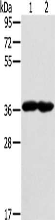Gel: 8%SDS-PAGE, Lysate: 40 μg, Lane 1-2: Mouse heart tissue, Mouse muscle tissue, Primary antibody: GNAT3 Antibody(GNAT3 Antibody) at dilution 1/400, Secondary antibody: Goat anti rabbit IgG at 1/8000 dilution, Exposure time: 1 minuteRabbit anti-Human GNAT3 Polyclonal Antibody