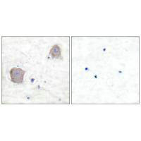 Immunohistochemical analysis of paraffin-embedded human brain tissue using GluR4 antibody.Rabbit anti-Human GRM4 Polyclonal Antibody