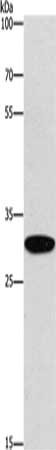 Gel: 8%SDS-PAGE, Lysate: 40 μg, Lane: Mouse kidney tissue, Primary antibody: EID3 Antibody(EID3 Antibody) at dilution 1/200, Secondary antibody: Goat anti rabbit IgG at 1/8000 dilution, Exposure time: 1 minuteRabbit anti-Human EID3 Polyclonal Antibody