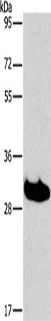 Gel: 15%SDS-PAGE, Lysate: 40 μg, Lane: Mouse liver tissue, Primary antibody: LAIR1 Antibody(LAIR1 Antibody) at dilution 1/550, Secondary antibody: Goat anti rabbit IgG at 1/8000 dilution, Exposure time: 30 seconds