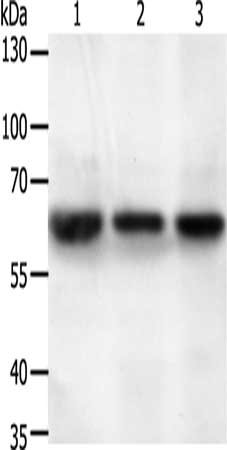 Gel: 10%SDS-PAGE, Lysate: 50 μg, Lane 1-3: A549 cells, human liver cancer tissue, Hela cells, Primary antibody: STXBP2 Antibody(STXBP2 Antibody) at dilution 1/200, Secondary antibody: Goat anti rabbit IgG at 1/8000 dilution, Exposure time: 40 secondsRabbit anti-Human STXBP2 Polyclonal Antibody