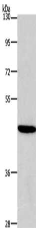 Gel: 8%SDS-PAGE, Lysate: 40 μg, Lane: 293T cells, Primary antibody: HDAC8 Antibody(HDAC8 Antibody) at dilution 1/950, Secondary antibody: Goat anti rabbit IgG at 1/8000 dilution, Exposure time: 3 secondsRabbit anti-Human HDAC8 Polyclonal Antibody