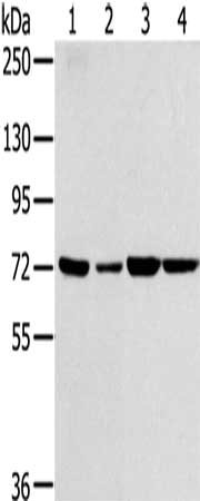 Gel: 8%SDS-PAGE, Lysate: 40 μg, Lane 1-4: NIH/3T3 cells, A549 cells, 293T cells, hela cells, Primary antibody: SNX2 Antibody(SNX2 Antibody) at dilution 1/300, Secondary antibody: Goat anti rabbit IgG at 1/8000 dilution, Exposure time: 10 secondsRabbit anti-Human SNX2 Polyclonal Antibody