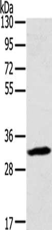 Gel: 8%SDS-PAGE, Lysate: 40 μg, Lane: Mouse lung tissue, Primary antibody: STX11 Antibody(STX11 Antibody) at dilution 1/400, Secondary antibody: Goat anti rabbit IgG at 1/8000 dilution, Exposure time: 20 secondsRabbit anti-Human STX11 Polyclonal Antibody
