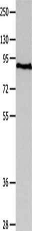 Gel: 10%SDS-PAGE, Lysate: 40 μg, Lane: Human fetal brain tissue, Primary antibody: MAGED1 Antibody(MAGED1 Antibody) at dilution 1/1200, Secondary antibody: Goat anti rabbit IgG at 1/8000 dilution, Exposure time: 90 seconds