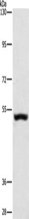Gel: 6%SDS-PAGE, Lysate: 40 μg, Lane: Mouse kidney tissue, Primary antibody: SYT17 Antibody(SYT17 Antibody) at dilution 1/650, Secondary antibody: Goat anti rabbit IgG at 1/8000 dilution, Exposure time: 1 minuteRabbit anti-Human SYT17 Polyclonal Antibody
