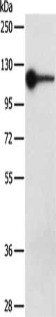 Gel: 8%SDS-PAGE, Lysate: 40 μg, Lane: Jurkat cells, Primary antibody: DDX58 Antibody(DDX58 Antibody) at dilution 1/250, Secondary antibody: Goat anti rabbit IgG at 1/8000 dilution, Exposure time: 3 minutesRabbit anti-Human DDX58 Polyclonal Antibody