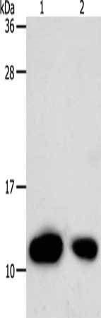 Gel: 12%SDS-PAGE, Lysate: 40 μg, Lane 1-2: Hela cells, human liver cancer tissue, Primary antibody: TXN Antibody(TXN Antibody) at dilution 1/700, Secondary antibody: Goat anti rabbit IgG at 1/8000 dilution, Exposure time: 20 secondsRabbit anti-Human TXN Polyclonal Antibody